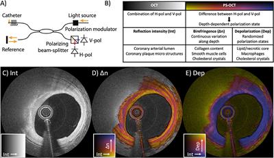 Intravascular Polarimetry: Clinical Translation and Future Applications of Catheter-Based Polarization Sensitive Optical Frequency Domain Imaging